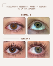 KosmaLash® | Sérum Crecimiento & Anticaída