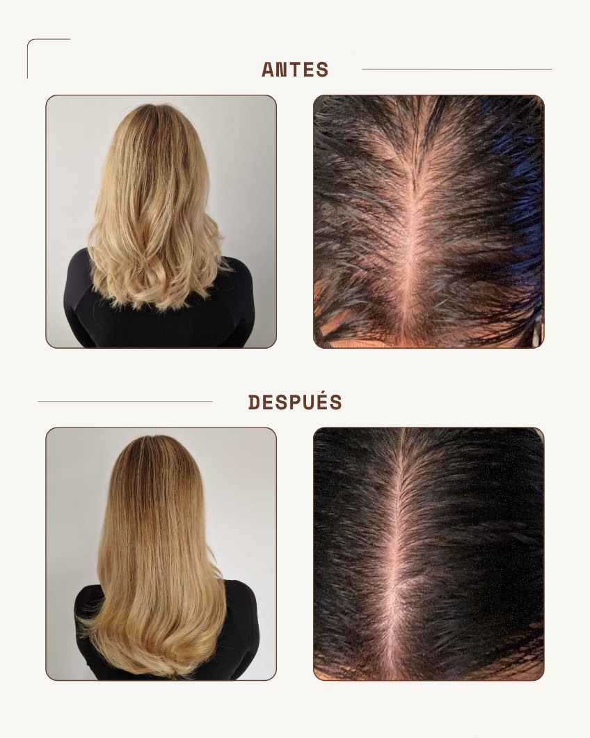 Aceite Crecimiento Capilar